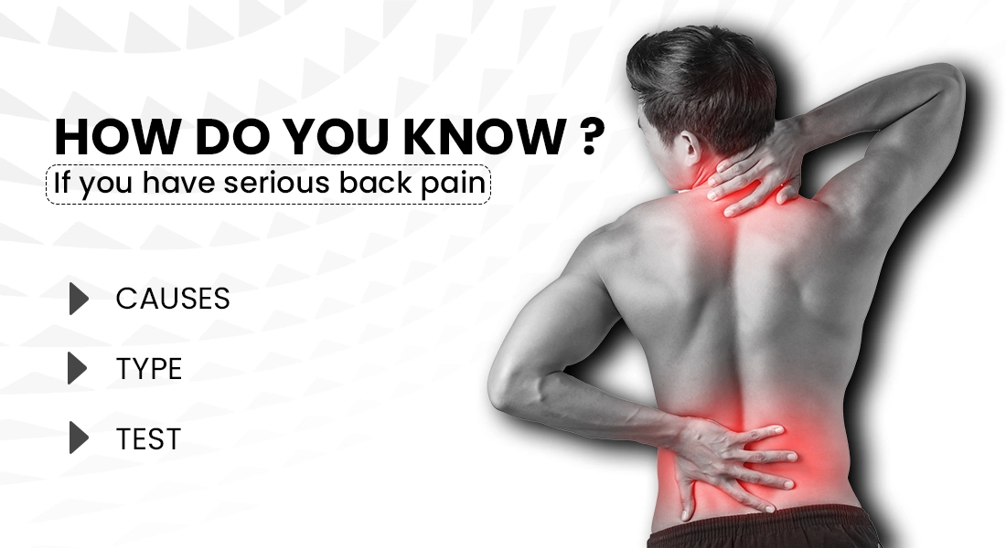 Is My Back Pain Serious? Check How, Its Cause, Type, Tests