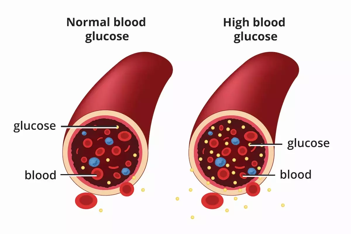 diabetes-and-heart-diseases-how-diabetes-affects-the-heart-dr-lal