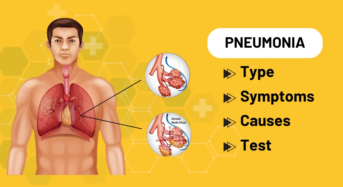 Pneumonia Outbreak: Know The Type, Symptoms, Causes And Test